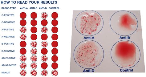 Blood Typing Blood Type Chart, Blood Type Personality, Different Blood Types, Medical Lab Technician, Blood Types, Science Models, Medical School Life, Bts Happy Birthday, Biology Labs