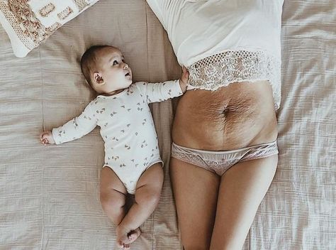 Mom Of 5 Shares Her Belly Photo To Celebrate The Beauty Of Woman Body | Bored Panda C Section Recovery, Belly Photos, Post Baby Body, Postpartum Body, Postpartum Care, Post Baby, Post Pregnancy, Baby Body, First Baby