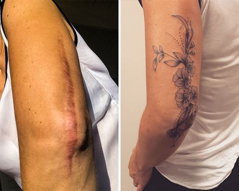 Vertical Tummy Scar Tattoo, Elbow Scar Tattoo, Ankle Tattoo Scar Cover, Long Scar Tattoo, Back Lift Scar Tattoo, Knee Replacement Scar Tattoo Cover Up, Inner Arm Scar Tattoo Coverup, Scare Tattoo Cover Ups, Long Scar Tattoo Cover Up