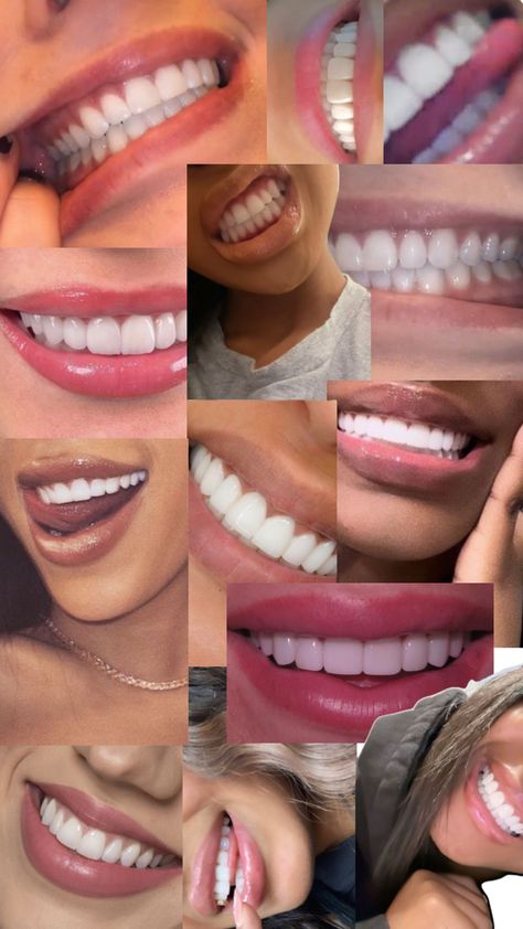 Teeth Goals! Oral hygiene Teeth Goals, Natural Teeth Whitening Diy, Teeth Aesthetic, Cute Braces Colors, Healthy Habits Motivation, Pretty Teeth, Braces Tips, Victoria's Secret Perfume, Cute Braces