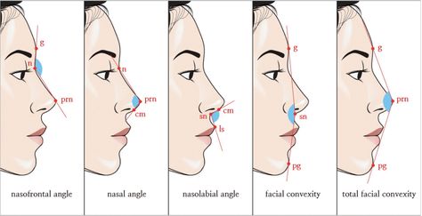 Angle Drawing Reference, Nose Angles, Angle Drawing, Of Aesthetic, Plastic Surgery, Drawing Reference, Surgery, Facial, Humanoid Sketch