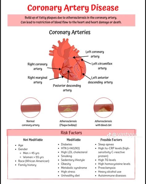 Cardiac Nurse Aesthetic, Cardiovascular Nursing, Pathophysiology Nursing, Medical Terminology Study, Paramedic School, Nursing School Essential, Cardiovascular Disorders, Nurse Study Notes, Nursing Mnemonics