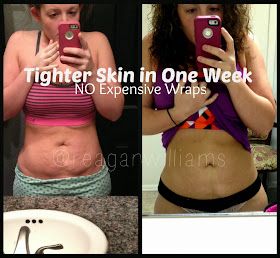 The Williams Family: How to Tighten Skin. Gonna try just can't get that bottom stomach skin sag to leave!!! Skin Tightening Stomach, Tighten Loose Skin, Tighten Skin, Tighter Skin, Glow Skin, Saggy Skin, Body Wraps, Loose Skin, Diy Body