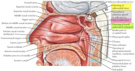 Learn about sphenoid sinus anatomy and its function. What are causes sphenoid sinus infection and how sinus infection treated. Sphenoid sinus surgery Sinus Anatomy, Acute Sinusitis, Paranasal Sinuses, Maxillary Sinus, Internal Carotid Artery, Sinus Cavities, Chronic Sinusitis, Soft Palate, Sinus Pain