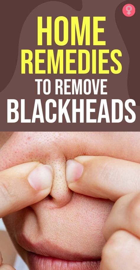 How To Remove Blackheads, Best Cough Remedy, Blackhead Remedies, To Remove Blackheads, Blackheads On Nose, Remove Blackheads, Natural Sleep Remedies, Natural Health Care, Natural Cold Remedies