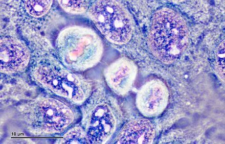 Human Cell, Henrietta Lacks, Cell Culture, Cell Line, Cell Division, Use Of Technology, Rocks And Crystals, Health Care, Abc