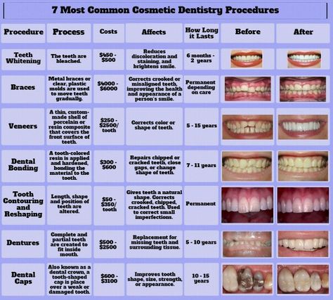 DISCOVER DENTISTS® Common Dental Procedures http://DiscoverDentists.com Dental Assistant Study, Cosmetic Dentistry Procedures, Dental Offices, Kesehatan Gigi, Kedokteran Gigi, Dental Hygiene School, Dental Implants Cost, Dental Facts, Emergency Dentist