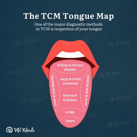 TCM Tongue Map Tongue Taste Buds, Herbal Teas, Traditional Chinese Medicine, Chinese Medicine, Health Issues, Traditional Chinese, Taste Buds, Health Tips, Soups