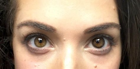 What are limbal rings and should you care that they're aging? - TODAY.com Contact Lenses Tips, Limbal Ring, Evolutionary Psychology, Saggy Neck, Anti Aging Tips, Look Older, Hazel Eyes, Pretty Eyes, Run Out