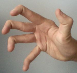 What is Hypermobility?... Hypermobility is a joint condition in which the joints move beyond the normal range expected.   Click here to learn about How Weight Training Helps Hypermobility:  http://wp.me/p2hs4t-f5 Double Jointed Fingers, Double Jointed, Ehlers Danlos, Ehlers Danlos Syndrome, Healthy Shopping, Fitness Blog, Hand Holding, Intp, Weight Training