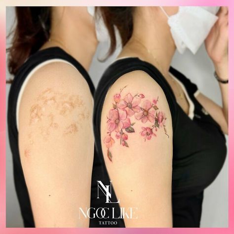 Vietnamese Tattoo, Tattoo Scar, Realistic Flower Tattoo, Tattoo Over Scar, Scar Cover Up, Tattoos To Cover Scars, Scar Tattoo, Healing Tattoo, Knee Tattoo