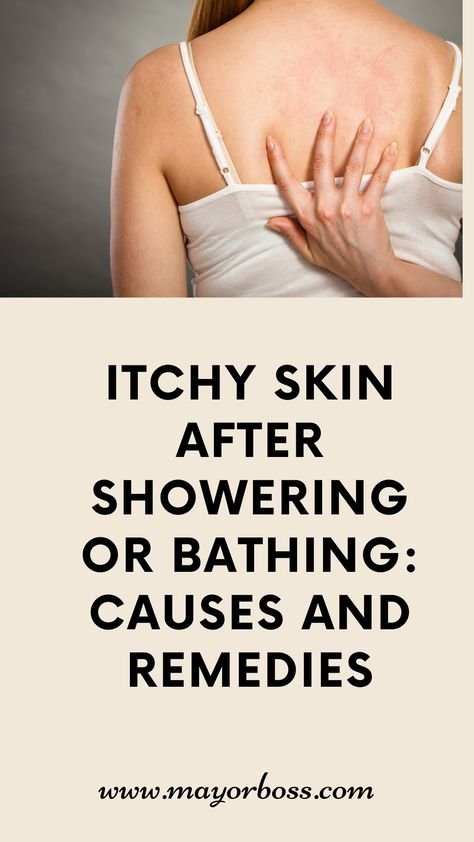 See the common causes of itchy skin after showering or bathing, and find effective remedies to alleviate the discomfort. From dry skin to allergies, learn about the triggers and solutions to restore your skin's comfort. Itching Skin Remedies, Dry Itchy Skin Remedies, Skin Rash Remedies, Itching Remedies, Itchy Skin Remedy, Remedies For Dry Mouth, Rashes Remedies, Warts Remedy, Oily Skin Remedy