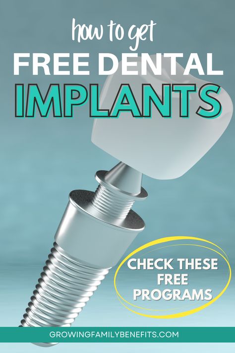 Struggling with the cost of dental care? Find out how to get free dental implants through grants and special programs designed to help those in need. Our detailed exploration covers everything from eligibility to application tips. Restore your smile and your confidence; learn more in this article. Free Grants For Dental Implants, Free Dental Implants, Implants Dental, Affordable Dental Implants, Implant Dentist, Dental Implants Cost, False Teeth, Dental Implant, Dental Procedures