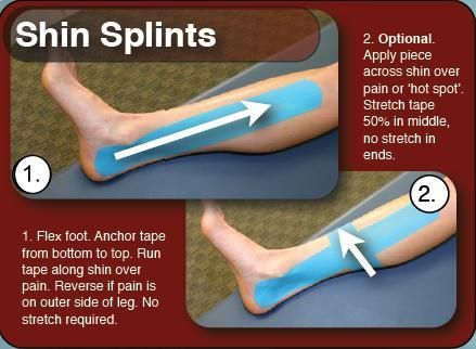 Shin Splints Taping, Shin Splints Stretches, Shin Splint Exercises, K Tape, Rehab Exercises, Kinesio Tape, Kt Tape, Kinesio Taping, Band Exercises