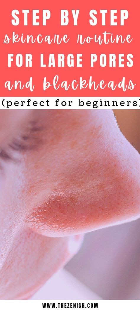 Skincare routine for large pores and blackheads How To Get Rid Of Blackheads On Nose Overnight, Skincare Routine For Large Pores, How To Get Rid Of Huge Pores, How To Get Rid Of Large Pores, Skin Care Routine For Oily Skin And Large Pores, Skin Care Routine For Pores, Skin Care For Large Pores, Pore Reducing Skincare, Large Pores How To Get Rid Of