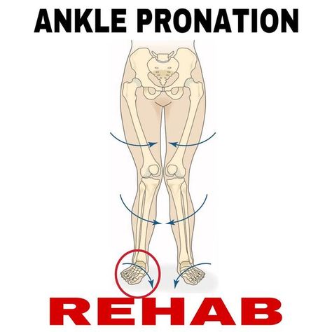 Ahmed Abdelghany on Instagram: "⚡️Over Pronation Syndrome⚡️ Over pronation refers to how the foot moves from side to side as the weight transfers from the heel to the foot as you go through your walking or running stride. And it occurs when the arch of the foot collapses excessively downward or inward and can lead to tibial rotation and femoral adduction and internal rotation (Knee Valgus), which increases the risk of Ankle, Knee And hip pain or injury. And here is a sample of corrective e Knee Valgus, Over Pronation, Running Stride, Shoulder Rehab, Knee Pain Exercises, Body Movement, Knee Pain Relief, Sprained Ankle, Hip Pain