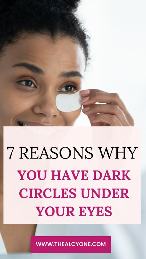 Eye Circle Remedies, Dark Circles Makeup, Dark Circle Remedies, Dark Circles Around Eyes, Hide Dark Circles, Dark Circles Treatment, Dark Eye Circles, Covering Dark Circles, Eye Cream For Dark Circles