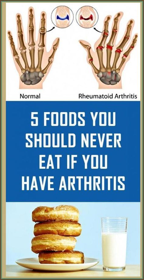 5 Foods You Should Never Eat If You Have Arthritis Processed Sugar, Super Foods, Inflammatory Foods, We Are The World, Frozen Meals, Vegan Diet, Health Awareness, Processed Food, Diet Tips