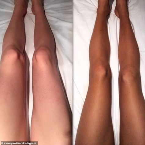 Many have shared their before and after photos - with impressive results... Sunbed Tanning Before And After, Pale To Tan Before And After, Before And After Spray Tan Pictures, How To Stay Tan Year Round, Best Self Tanner Before And After, Tanning Drops Before And After, Melanotan 2 Before And After Tans, Tanning Before And After, Tanned Af Before And After