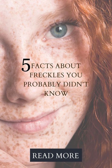 5 Facts About Freckles You Probably Didn’t Know Makeup Ideas Freckles, Freckled Skin Makeup, How To Enhance Freckles Naturally, How To Make Your Freckles Pop, Freckles On Tan Skin, Hair For Freckled Skin, Freckles Skin Care, Freckles All Over Face, Tattoos Over Freckles