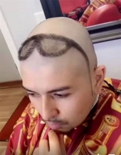 Horrible Hair, Bald Haircut, Weird Haircuts, Short Hair For Boys, Guy Haircuts Long, Mens Hairstyles Thick Hair, Bad Haircut, Bald Hair, Haircut Designs