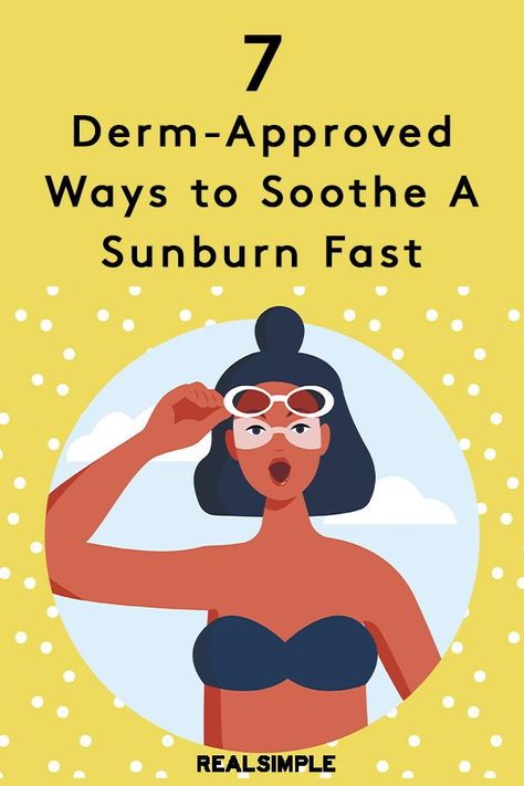 Sun Burn Remedy Face, Sun Burn Remedy Overnight, Sun Burn Remedy, Heal Sunburn Fast, Sunburn On Face, Sunburn Face, Sunburn Blisters, How To Help Sunburn, Home Remedies For Sunburn