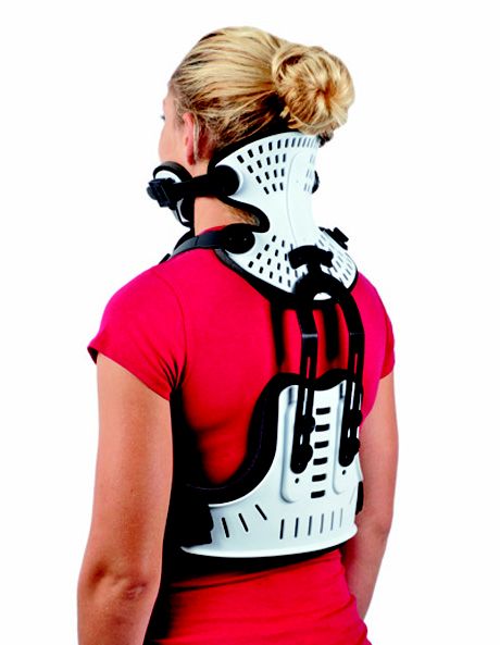 The symptoms are similar to ankylosing spondylitis and osteoarthritis of the spine including warmth and swelling in the joints. Halo Brace, Cauda Equina, Orthopedic Brace, Cervical Pain, Shoulder Brace, Spinal Surgery, Brace Face, Back Brace, Hand Therapy