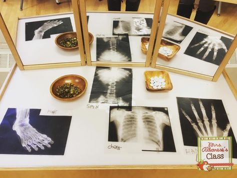 Exploring x-rays on the light table today - students labelled the x-ray to the correct body part and used loose parts to outline them. There is such an interest in the human body in our class this year! . . Science Eyfs, All About Me Topic, Light Box Activities, Marvellous Me, Nursery Rhymes Activities, People Who Help Us, Eyfs Activities, X Rays, Messy Play