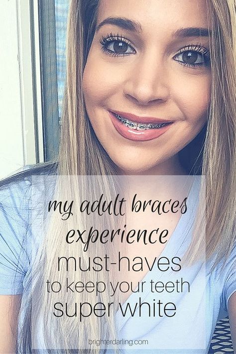 Women With Braces, Braces Food, Teeth Whitening Dentist, Adult Braces, Skincare Steps, Braces Tips, Getting Braces, Clear Braces, Teeth Whitening Diy