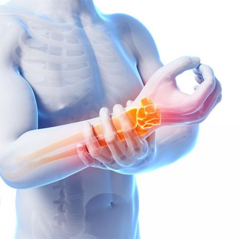 wrist stretches, wrist pain, carpal tunnel remedies, helping wrist pain, wrists Carpal Tunnel Remedies, Inflammation Remedies, Wrist Stretches, Natural Headache, Wrist Pain, Nerve Pain Relief, Joints Pain Relief, Carpal Tunnel, Chiropractic Care