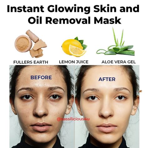 Skin Lightening Diy, Potato Juice, Skin Diet, Skin Face Mask, Clear Skin Face, Glowing Skin Mask, Face Care Tips, Dry Skin On Face, Face Pack