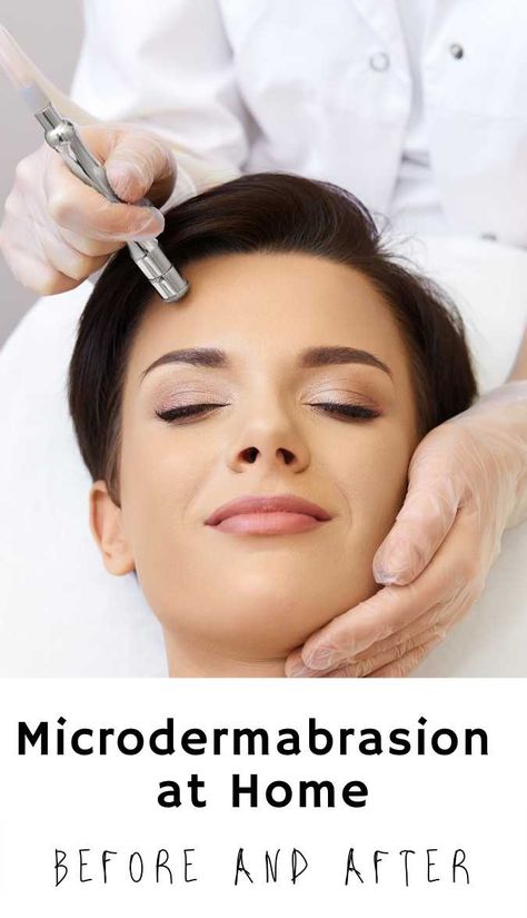 Dermabrasion Before And After, Microdermabrasion At Home, Microdermabrasion Before And After, Home Microdermabrasion, Aloe Vera Face Mask, Skin Resurfacing, Cosmetic Treatments, The Dating Divas, Body Treatments