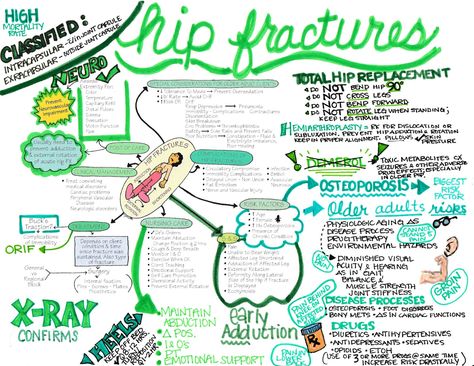 Fractures Nursing, Cardiovascular Notes, Dna Notes, Doctor Notes, Medical Essentials, Musculoskeletal Disorders, Emt Basic, Nbcot Exam, Nursing School Prep