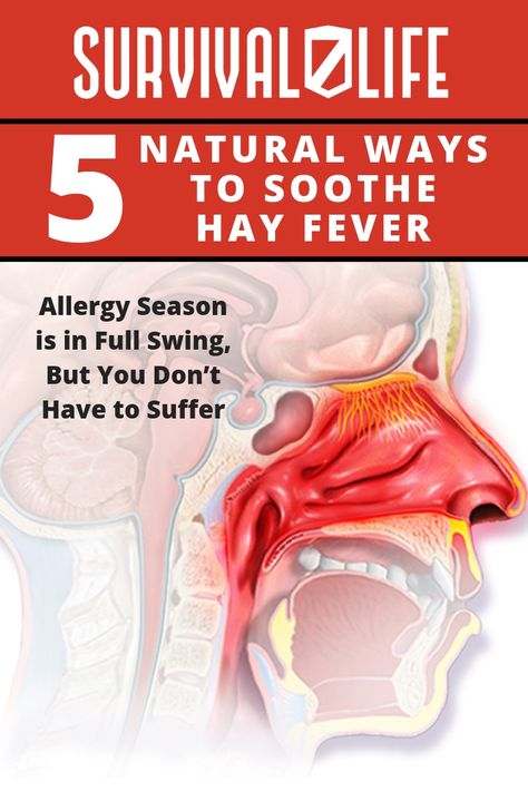 5 Natural Ways to Soothe Hay Fever | Survival Life Hayfever Remedies, Healthy Cleaning Products, Fever Rash, Remedies For Allergies, Hay Fever Symptoms, Home Remedies For Allergies, Fever Symptoms, High Blood Pressure Diet, Allergic Rhinitis