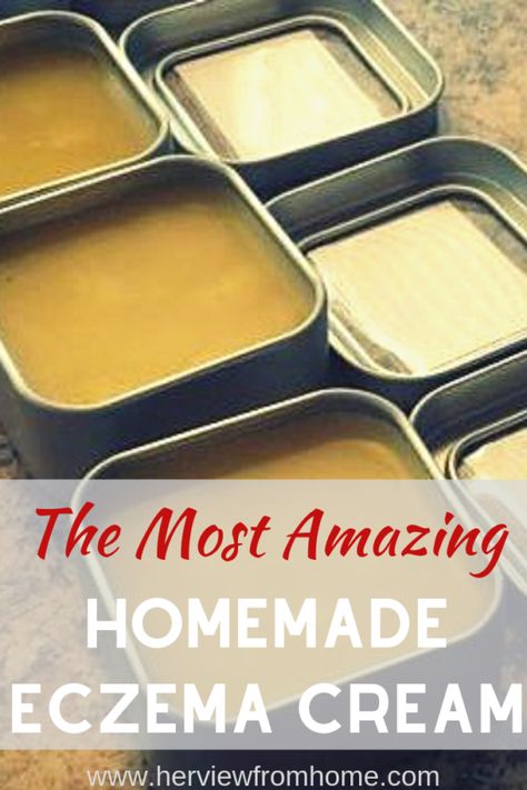 The Most AMAZING Eczema Cream EVER! - Her View From Home Salve Recipes, Healing Salves, Homemade Lotion, Eye Creams, Homemade Bath Products, Homemade Soap, Lotion Bars, Skin Care Recipes, Soap Recipes