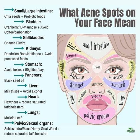 Food For Acne, Probiotic Foods, Home Doctor, Large Intestine, Acne Spots, Improve Health, Health And Beauty Tips, Health Facts, Body Health