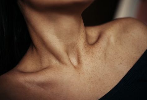 Clavicle (collarbone) pain: Causes, home remedies, and prevention tips Tech Neck, Antiaging Skincare Routine, Tissue Types, Neck Bones, Sensitive Skin Care, Body Reference, Skin Healing, Wrinkle Remover, Anti Aging Skin Products