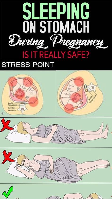 Sleeping positions while pregnant Baby Jas, 5 Weeks Pregnant, Pregnancy Info, How To Sleep, Pregnancy Information, Pumping Moms, Baby Sleep Problems, Mom Junction, First Trimester