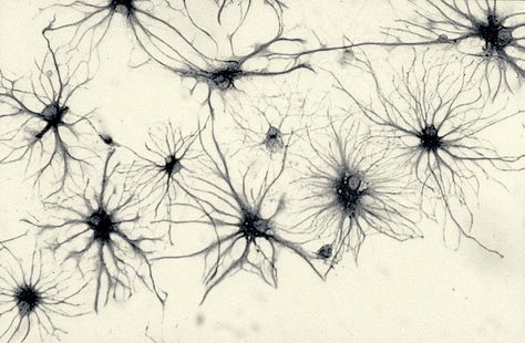 Brain Synapse Art, Neural Pathways Art, Neurology Art Illustrations, Neuroplasticity Art, Neuron Sketch, Neuron Aesthetic, Synapse Neurons Art, Neurology Aesthetic, Neurons Art