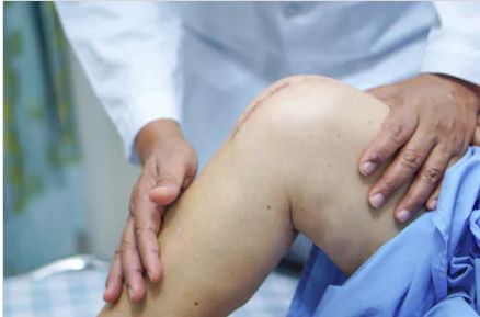 My knee still hurts after surgery… » Mayo Clinic Connect Spine Health, Orthopedic Surgery, Knee Surgery, Knee Replacement, After Surgery, Mayo Clinic, Medical Education, Bone Health, Knee Pain