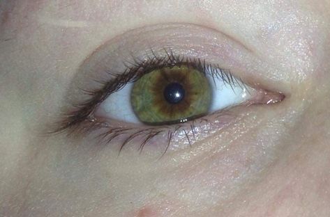 central heterochromia with green and brown, eyes Green And Brown Heterochromia Eyes, Brown And Green Heterochromia, Heterochromia Eyes Brown And Green, Central Heterochromia Eyes Green Brown, Hetorcromia Eyes, Scp Oc, Sectoral Heterochromia, Central Heterochromia, Heterochromia Eyes