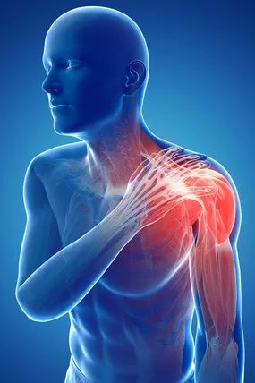 How Serious Is Bone Marrow Edema? Tattoo On Top Of Shoulder, Shoulder Pain Remedies, Shoulder Blade Pain, Shoulder Injury, Herbs Tea, Pakistan Karachi, Pinched Nerve, Frozen Shoulder, Core Stability