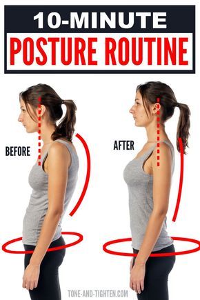 Exercise For Back Straight, Upper Back Exercises At Home, How To Fix Upper Back Posture, Best Excersize For Back, Back Exercises Women Posture, How To Fix Lower Back Posture, Flat Back Exercise, Back Straight Exercise, Fix Your Posture Exercise