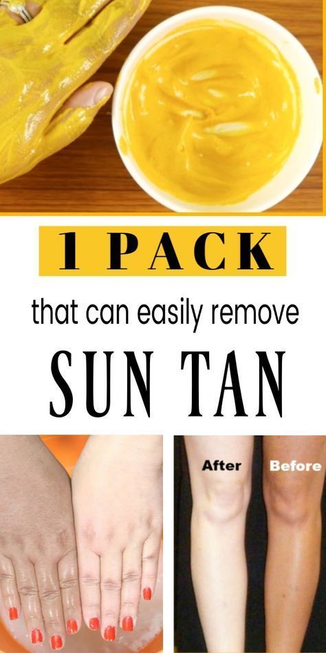 #SuntanRemoval #SuntanRemovalTips Suntan removal remedies how to remove sun tan from hands how to remove tan from face for womens sun tan removal cream how to remove tan from face for mens how to remove tan from feet how to remove old tan from face how to remove tan from neck how to remove tan from forehead Tan Removal Remedies, Tan Removal Home Remedies, Remove Tan From Face, Tan Removal Face Pack, Skin Tan Removal, Sun Tan Removal, Natural Bleach, Instant Tan, Sun Burn