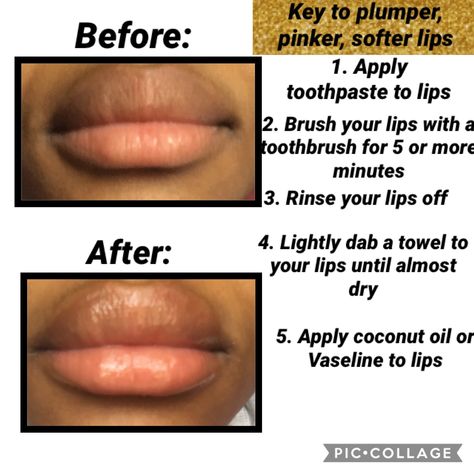 How To Get Plum Lips Naturally, Plum Lips Natural, How To Have Nice Lips, How To Lighten Lips Fast, How To Get Bigger Lips Naturally, How To Get Bigger Lips, How To Get Soft Lips, Lighten Lips, Bigger Lips Naturally