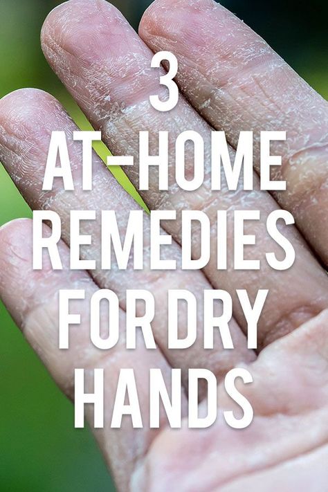 Nothing is worse than rough, dry, cracked hands. And when winter hits, like it inevitably (and unfortunately) does, it seems like there’s nothing we can do to avoid our hands from becoming this way. But before you run to the nearest drugstore to buy a quick fix, you should know that you probably already have ingredients in your own kitchen that you could use to bring your dry hands back to life! Dry Cracked Hands Remedy, Cracked Hands Remedy, Hand Remedies, Dry Hands Remedy, Extremely Dry Hands, Itchy Hands, Homemade Deodorant Recipe, Dry Hand Skin, Dry Cracked Hands