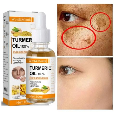 49122793586848 Moisturizing Skin Care, Turmeric Essential Oil, Turmeric Oil, Dark Spots On Skin, Remove Dark Spots, Skin Care Remedies, Shrink Pores, Skin Care Solutions, Improve Skin Texture