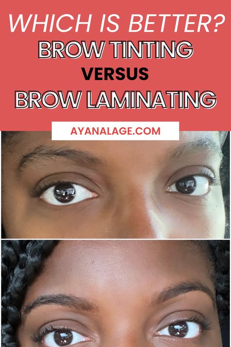 The best tips and everything you need to know about brow tinting! I am sharing my brow tinting before and after and explaining why I prefer it to brow laminating! Eyebrow Lamination Before And After, Brow Lamination Before And After, Sunburn Peeling, Eyebrow Before And After, Henna Eyebrows, Eyebrows Microblading, Brow Threading, Dark Eyebrows, Henna Brows