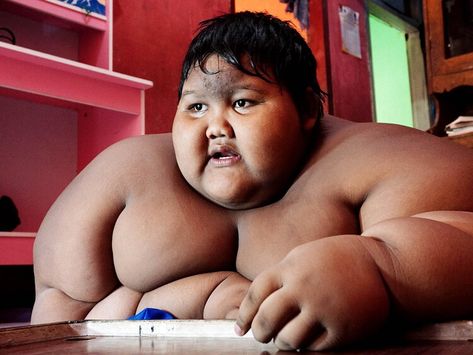 ‘World’s fattest boy’ is now unrecognisable — news.com.au