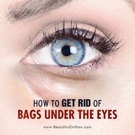 How to Get Rid of Bags Under the Eyes | Beautiful on Raw Undereye Bags Remedy, Eye Bag Remedies, Puffy Eyes Remedy, Baggy Eyes, Eye Bags Treatment, Eye Roller, Eyes Beautiful, Under Eye Puffiness, Healthy Advice